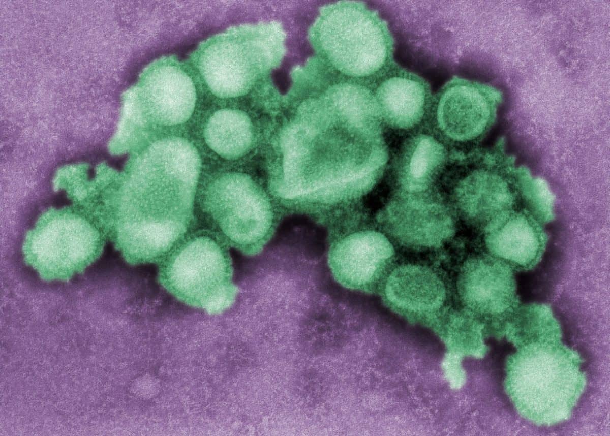 H1N1 swine flu with ‘pandemic potential’ found