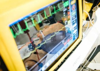 Why is the government restricting Medicare funds for ECGs