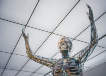 Plan early rheumatological intervention