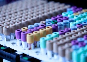 The harms of inaccurate mass antigen testing