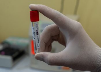 Not all tests are equal