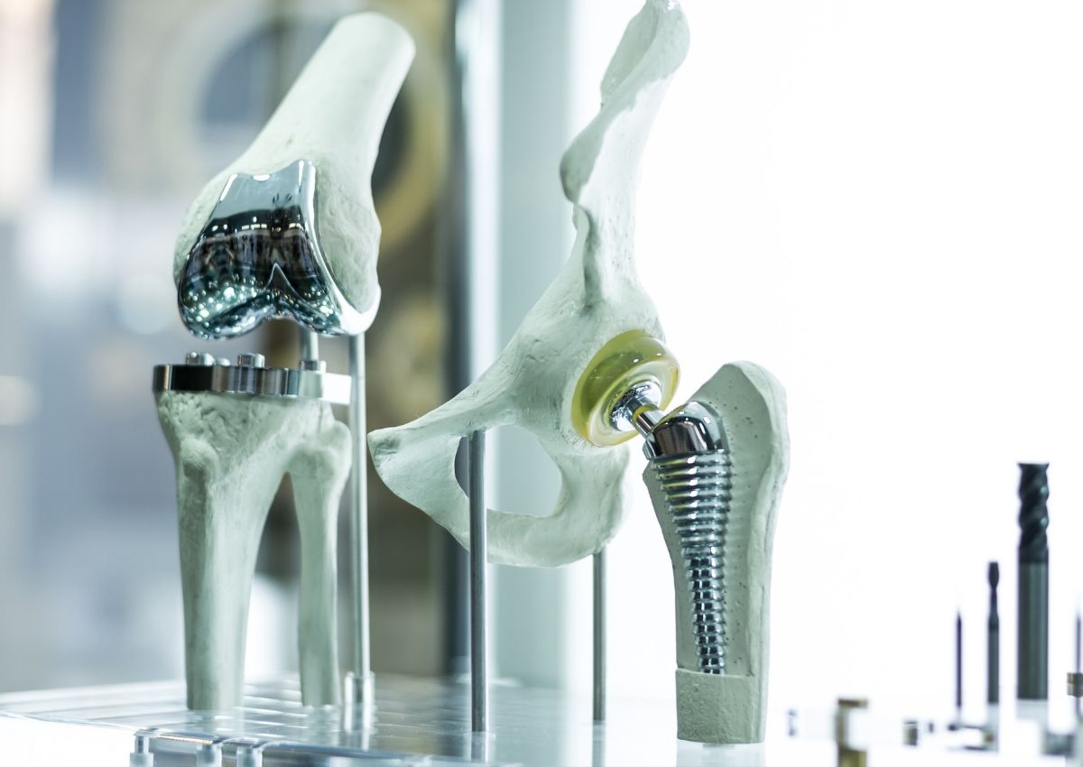 Scientists secure €1 million grant to develop synthetic tendon and ligament implants